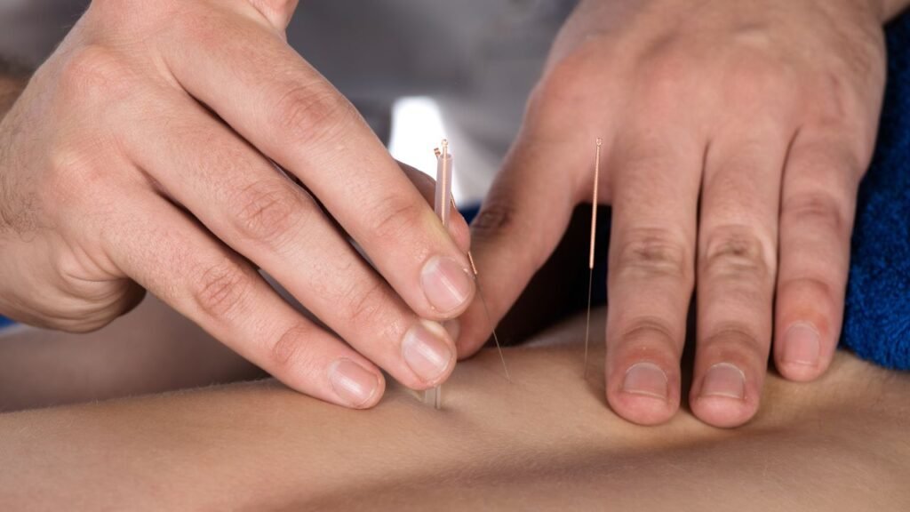 How Acupuncture Can Help Alleviate Stress and Anxiety Symptoms - Health Gate Utama